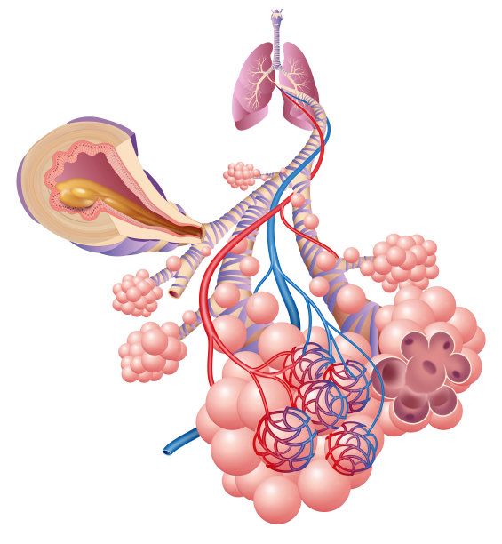 inflammation