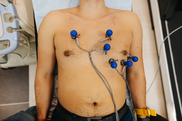ecg