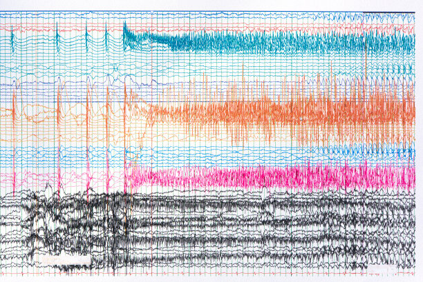 eeg