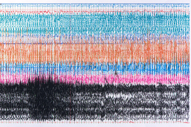 eeg