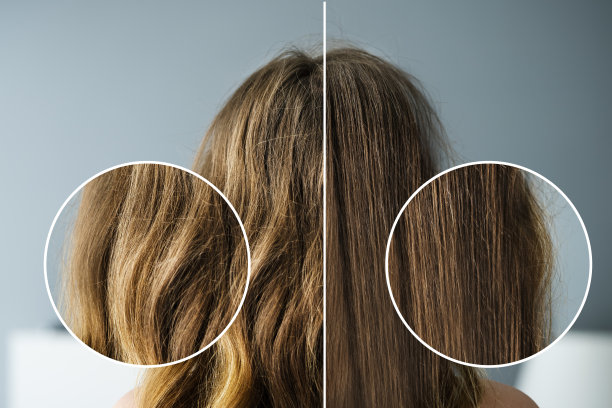 hair