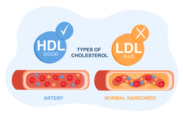 cholesterol