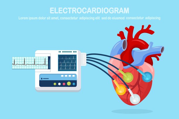 ekg