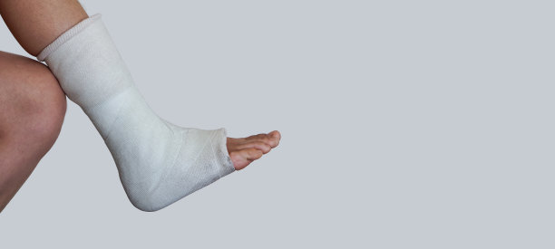 cast