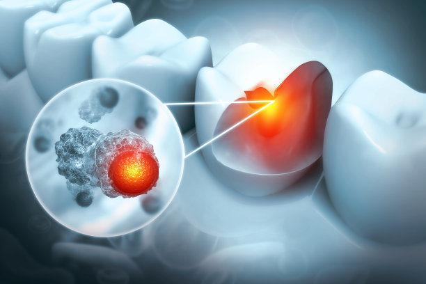 inflammation