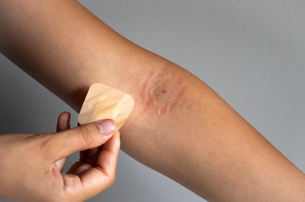 adhesive