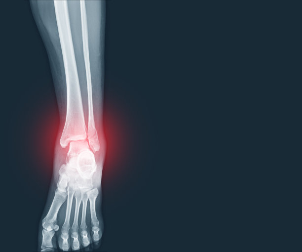 tibia