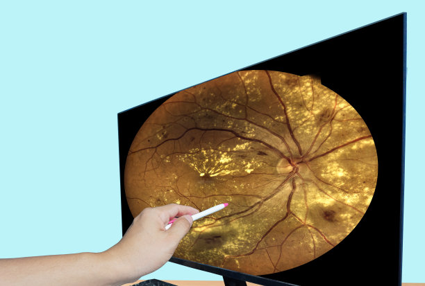 retina