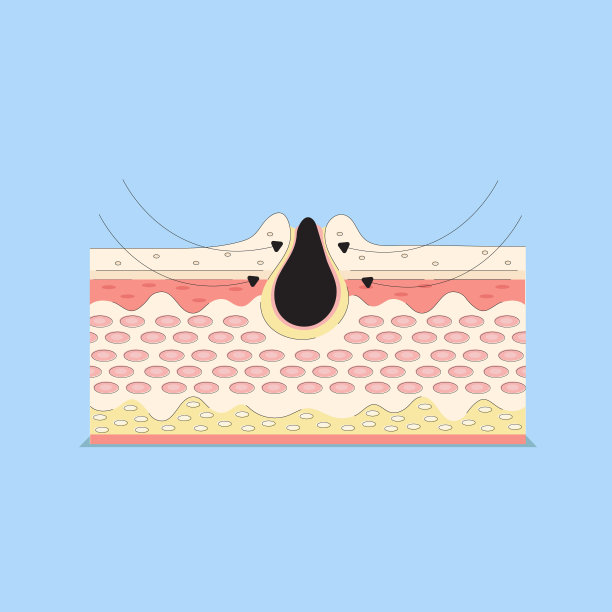 pores