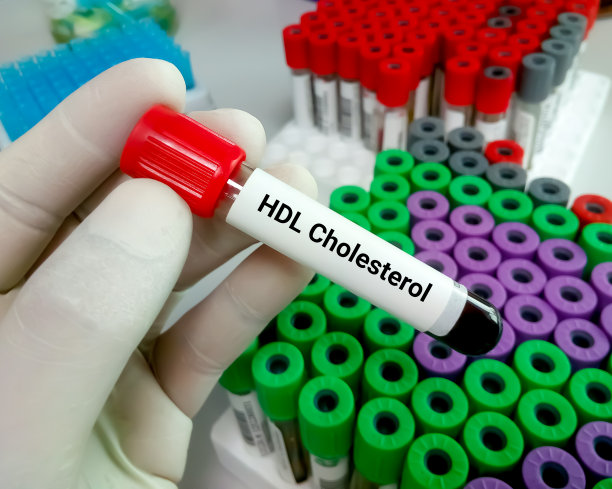 cholesterol