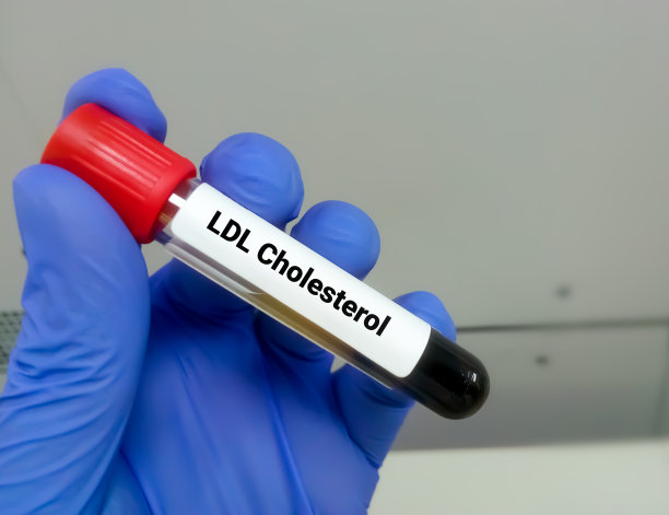cholesterol