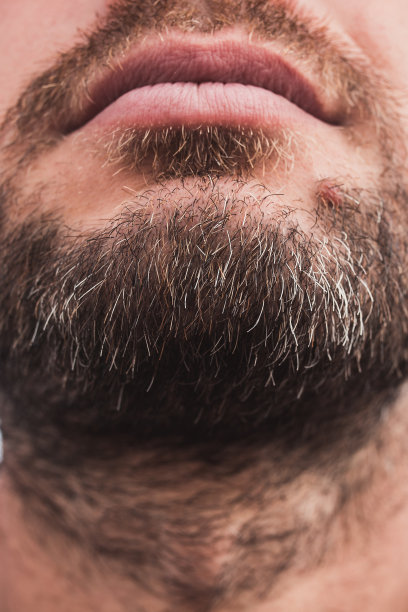 beard