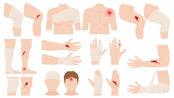 cuts
