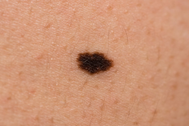 mole