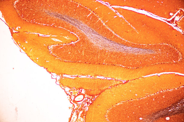 medulla