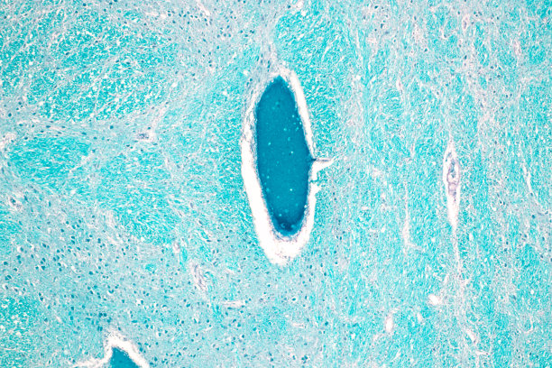 medulla