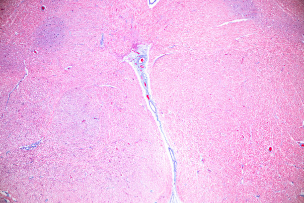 medulla