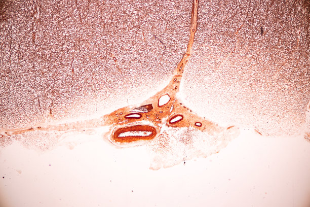 medulla