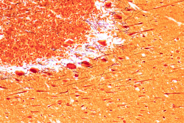 medulla
