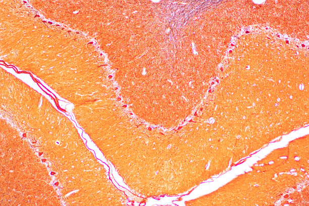 medulla