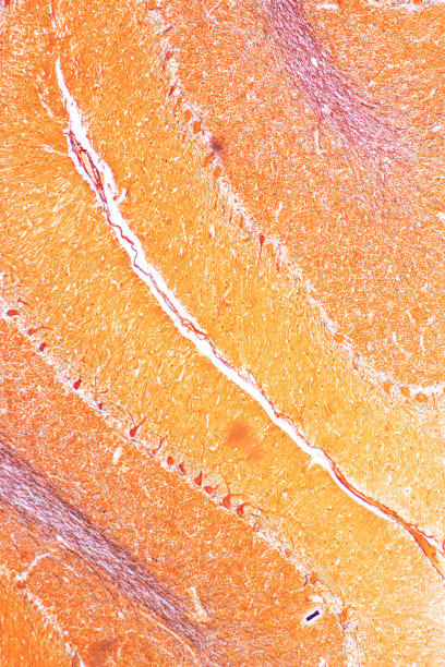 medulla