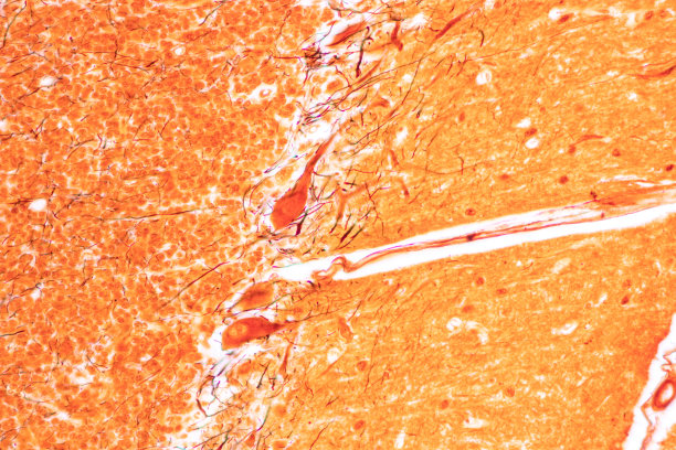 medulla
