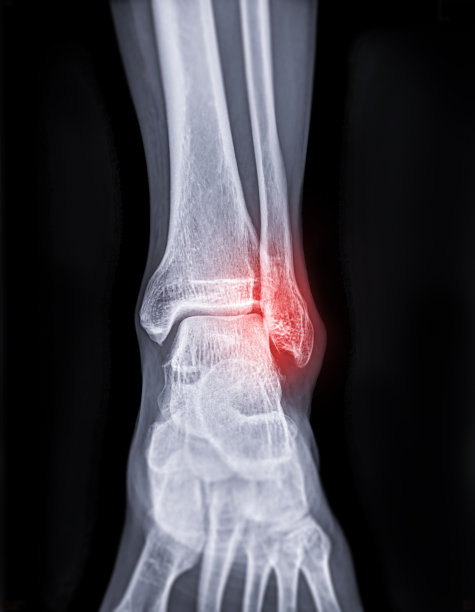 tibia