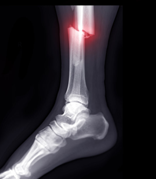 tibia