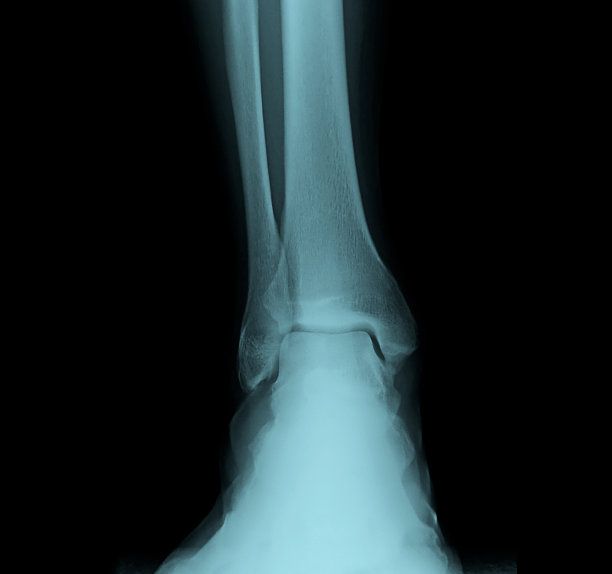 tibia