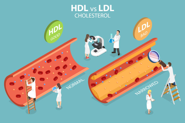 cholesterol