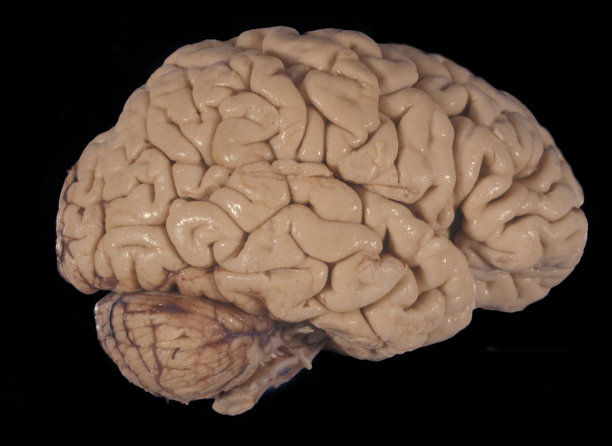 cerebrum