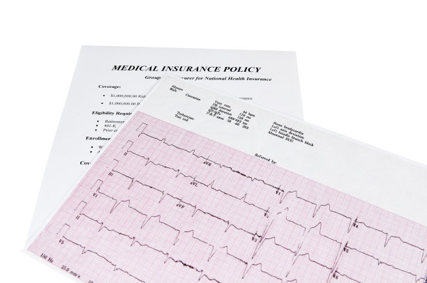 ekg