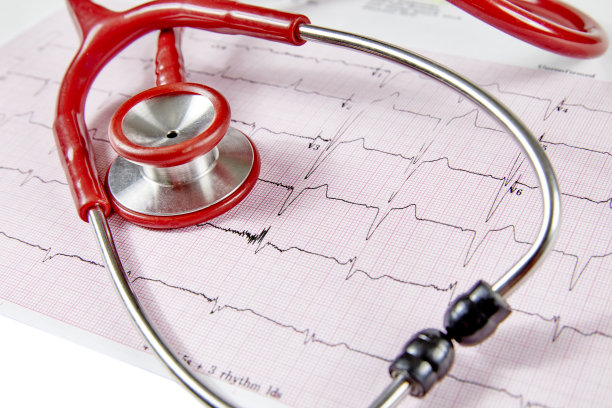 ekg