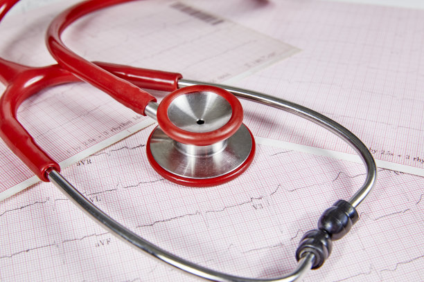 ekg