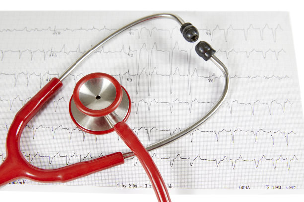 ekg