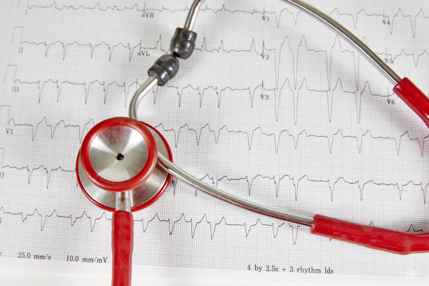 ekg
