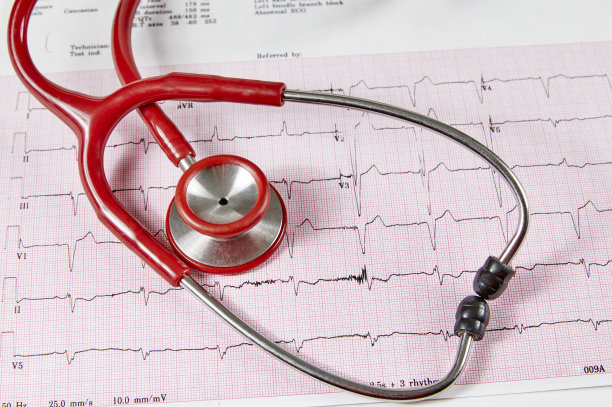 ecg