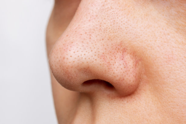 nose