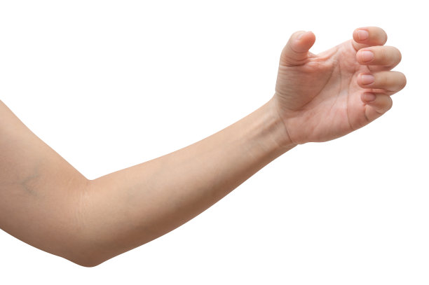 arms