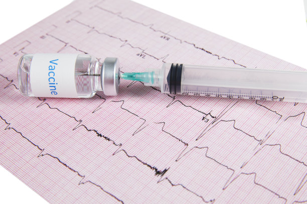 ekg