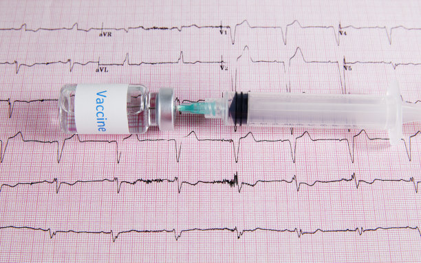 ecg