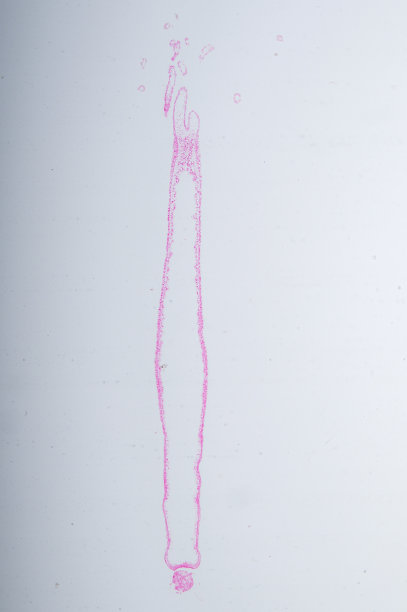 cnidaria