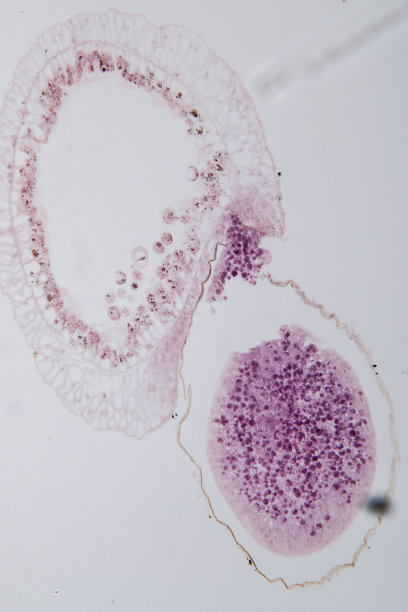 cnidaria