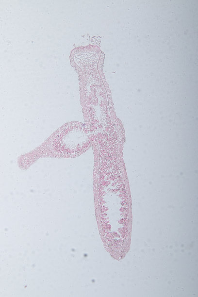 cnidaria