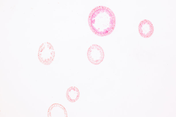 cnidaria
