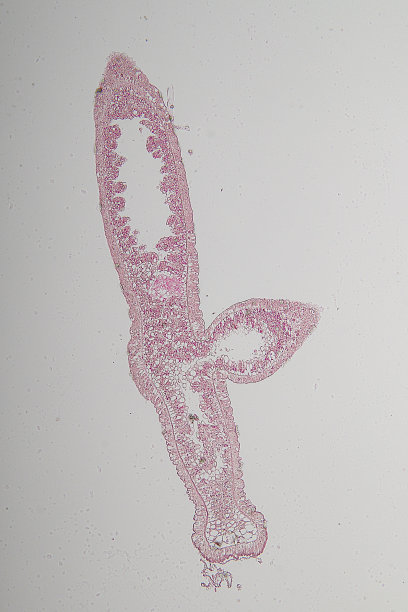 cnidaria