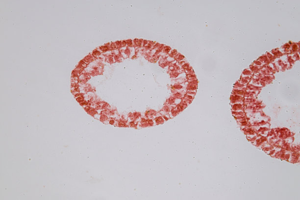 cnidaria