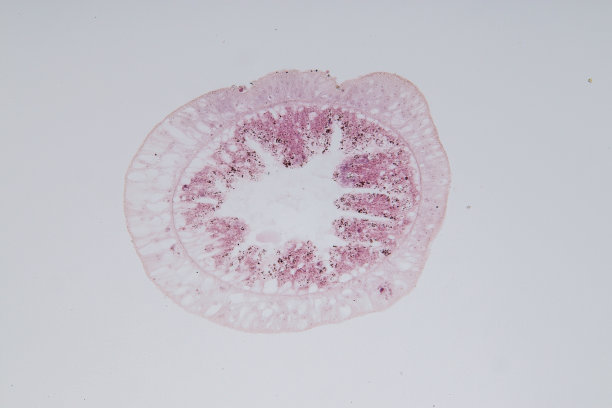 cnidaria