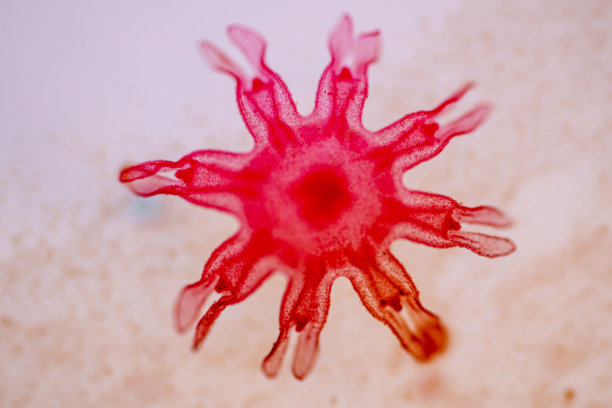 cnidaria