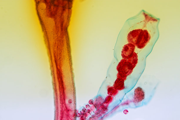 cnidaria